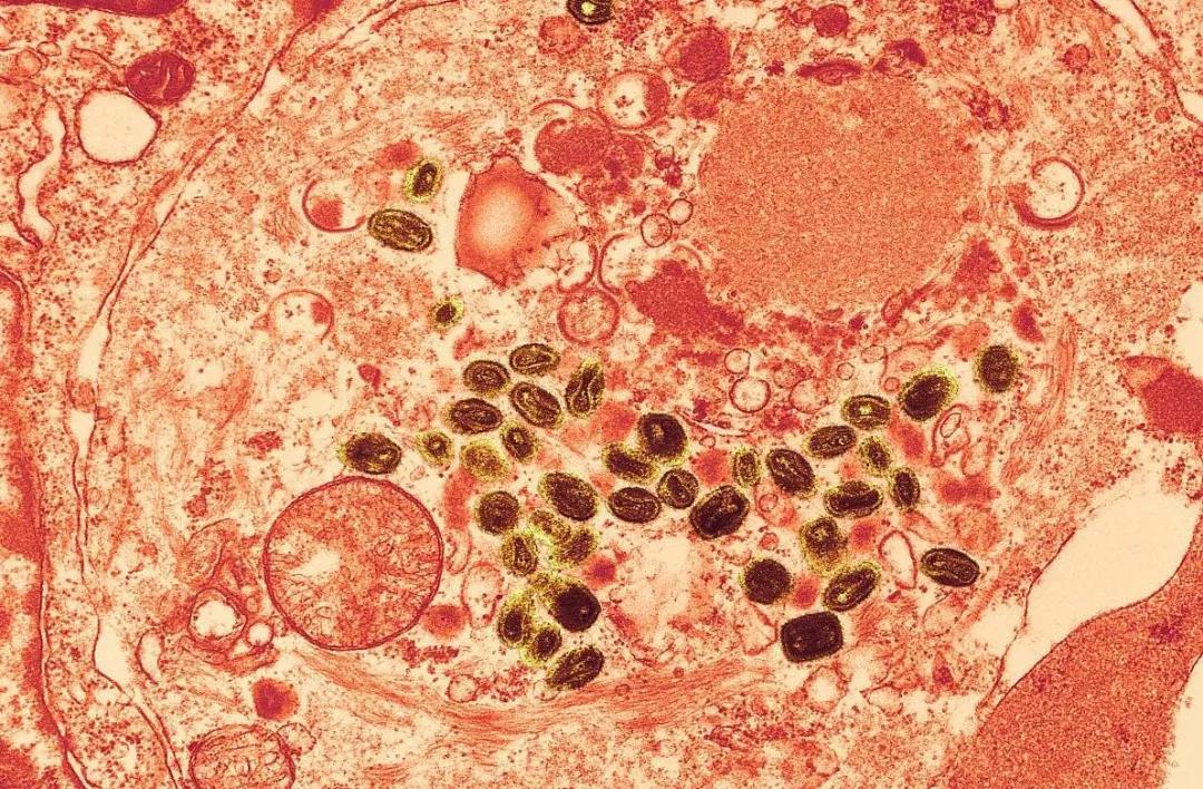 在天花最为猖獗的时期，清朝用什么措施避免或减少感染天花