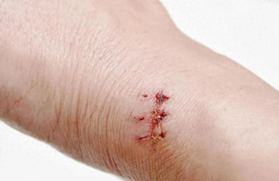 手机离得这些功能你知道吗！关键时刻能救你一命！你肯定不知道！