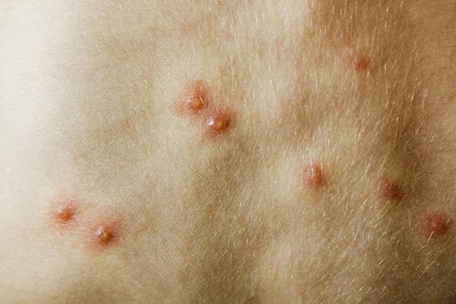 kiayun手机版登录.v1008.点进白给你1888.中国 羊感染羊痘病毒的临床症状及防控措施