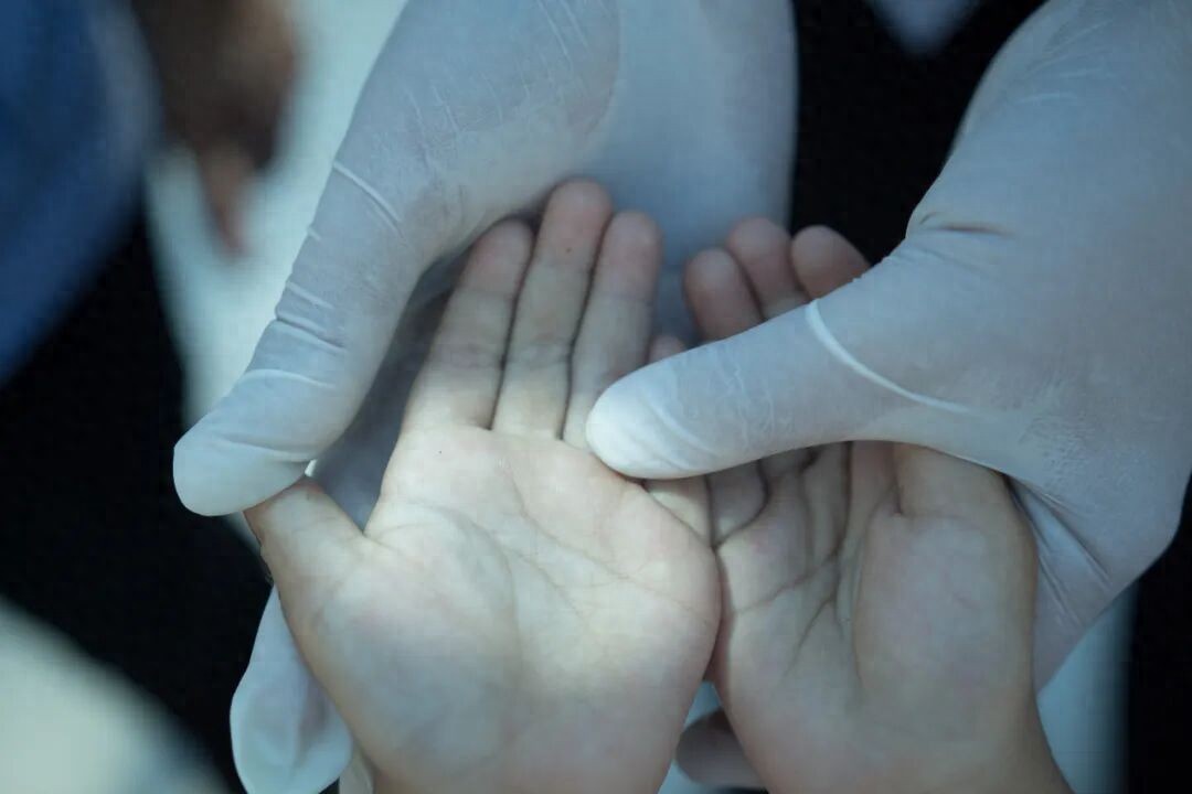 kiayun手机版登录.v1008.点进白给你1888.中国 家长必看：关于手足口病，最需要知道的5件事