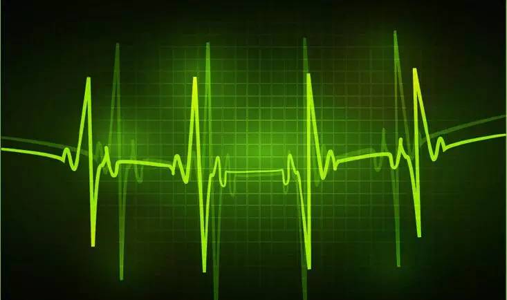 kiayun手机版登录app游戏登录入口.手机端安装.cc “特发性室性心动过速”和“射频消融术”