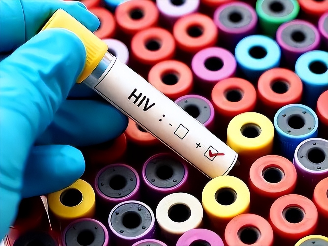 kiayun手机版登录下载 艾滋病发出的首要信号，往往在皮肤上！皮肤出现这些症状要警惕