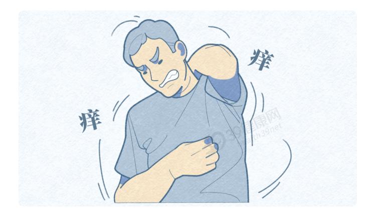 艾滋病皮疹特点_艾滋病皮肤症状_艾滋病 长痘